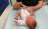 Петербургские медики помогли девочке с врожденным вывихом коленного сустава