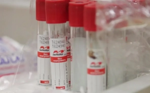 За последние сутки на коронавирус обследовались более 43 тыс. петербуржцев