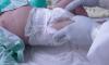 Петербургские врачи провели уникальную операцию, позволившую дышать трехмесячному малышу