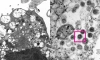 Опубликована микрофотография штамма коронавируса "Омикрон"