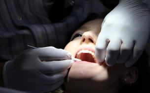 Врач назвал главные причины выпадения зубов