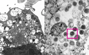 Опубликована микрофотография штамма коронавируса "Омикрон"