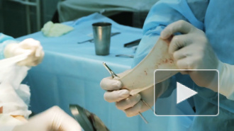 В России людям начнут пересаживать органы от животных