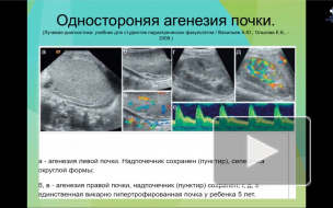 Аномалии развития почек глазами врача визуальной диагностики. Лукьянова А. А.