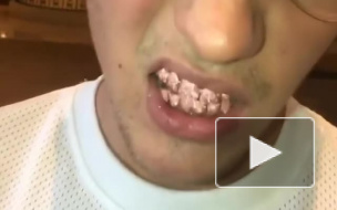 Видео: Джастин Бибер украсил зубы бриллиантами и сапфирами