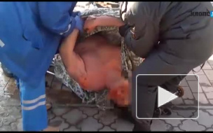 В Калининграде разъяренный нудист откусил палец у горе-папарацци