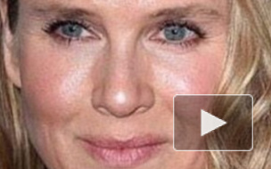 Внешность изменившейся до неузнаваемости Рене Зеллвегер по деталям разобрали пластические хирурги