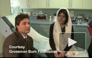 Афганскую девушку прооперировали в США. Муж отрезал ей нос и уши