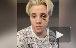 Избитая в Петербурге битбоксерша Оля Кекс рассказала о ходе следствия