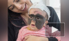 Мама девочки с родимым пятном на все лицо показала результат операций в Краснодаре 